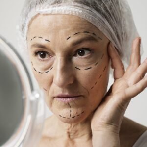 Líneas de Envejecimiento – Tercio Superior